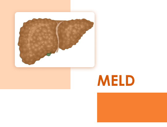 Индекс MELD